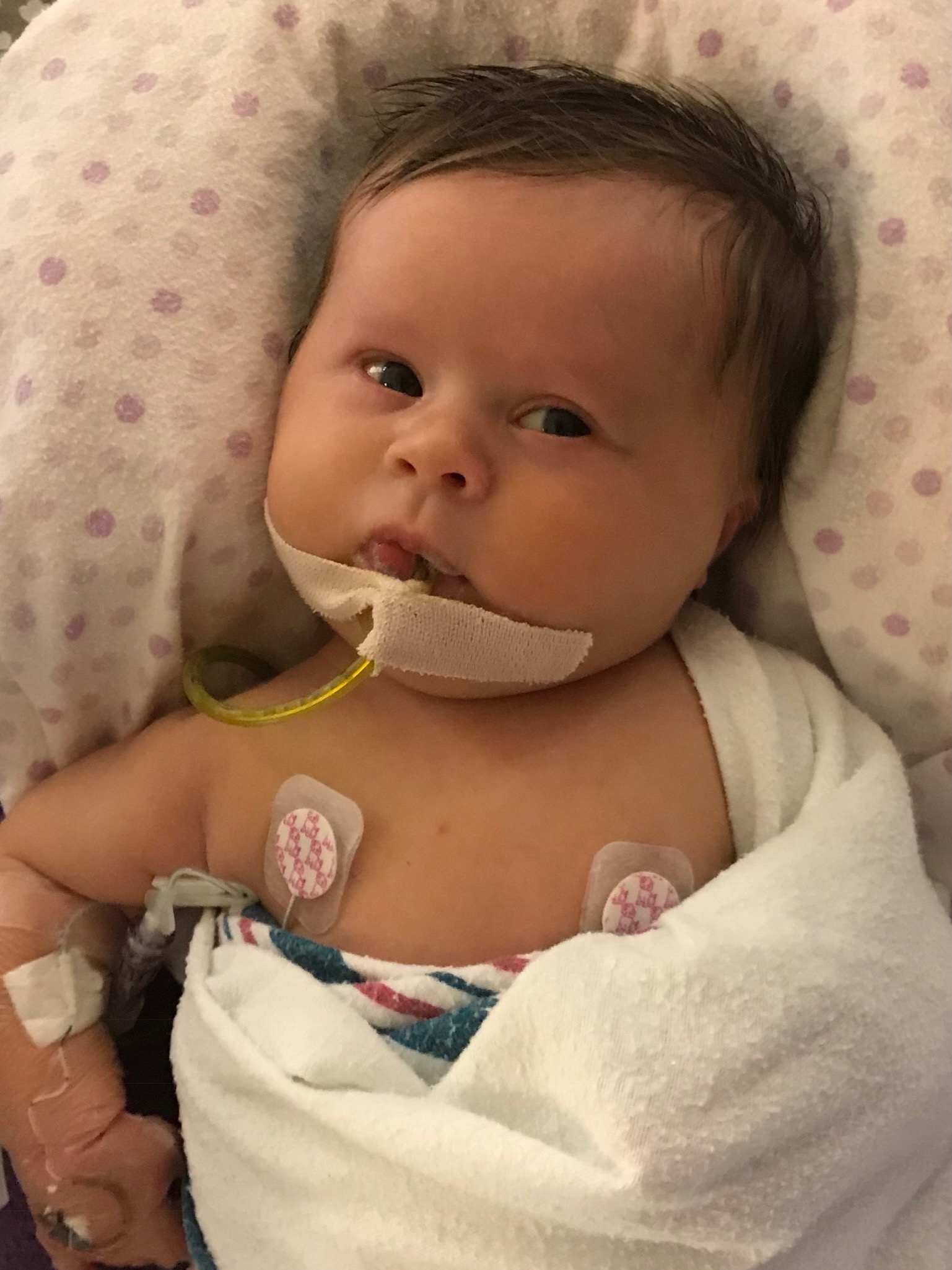 Baby in the NICU with monitoring equipment
